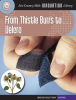 From_Thistle_Burrs_to____Velcro