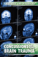 Concussions_and_Other_Brain_Trauma
